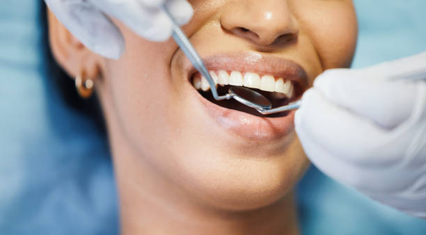 Best Urgent Care for Lost Fillings or Crowns in Fort Campbell North, KY