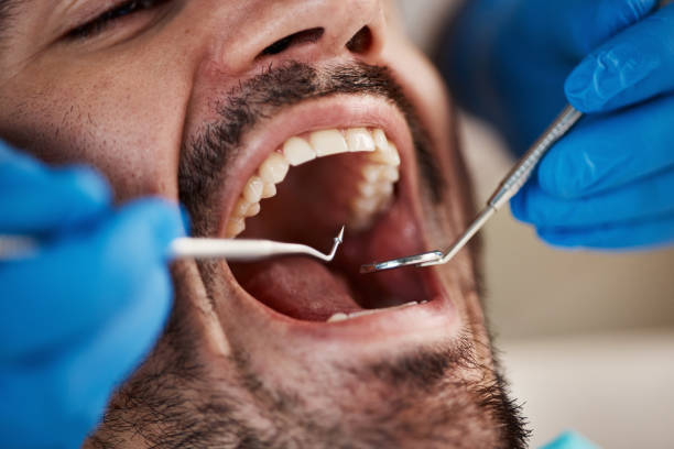 Best Emergency TMJ Treatment in Fort Campbell North, KY
